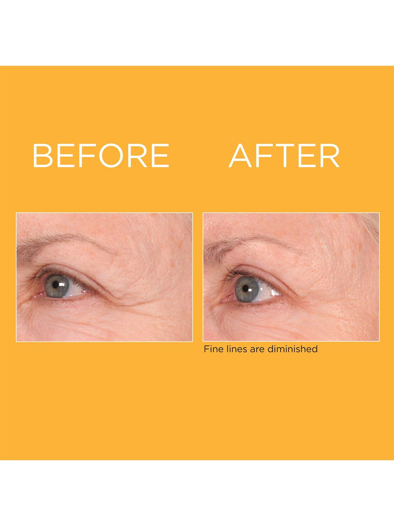 Image 5 of 5 of Elizabeth Arden Prevage Progressive Renewal Treatment 4x 10ml