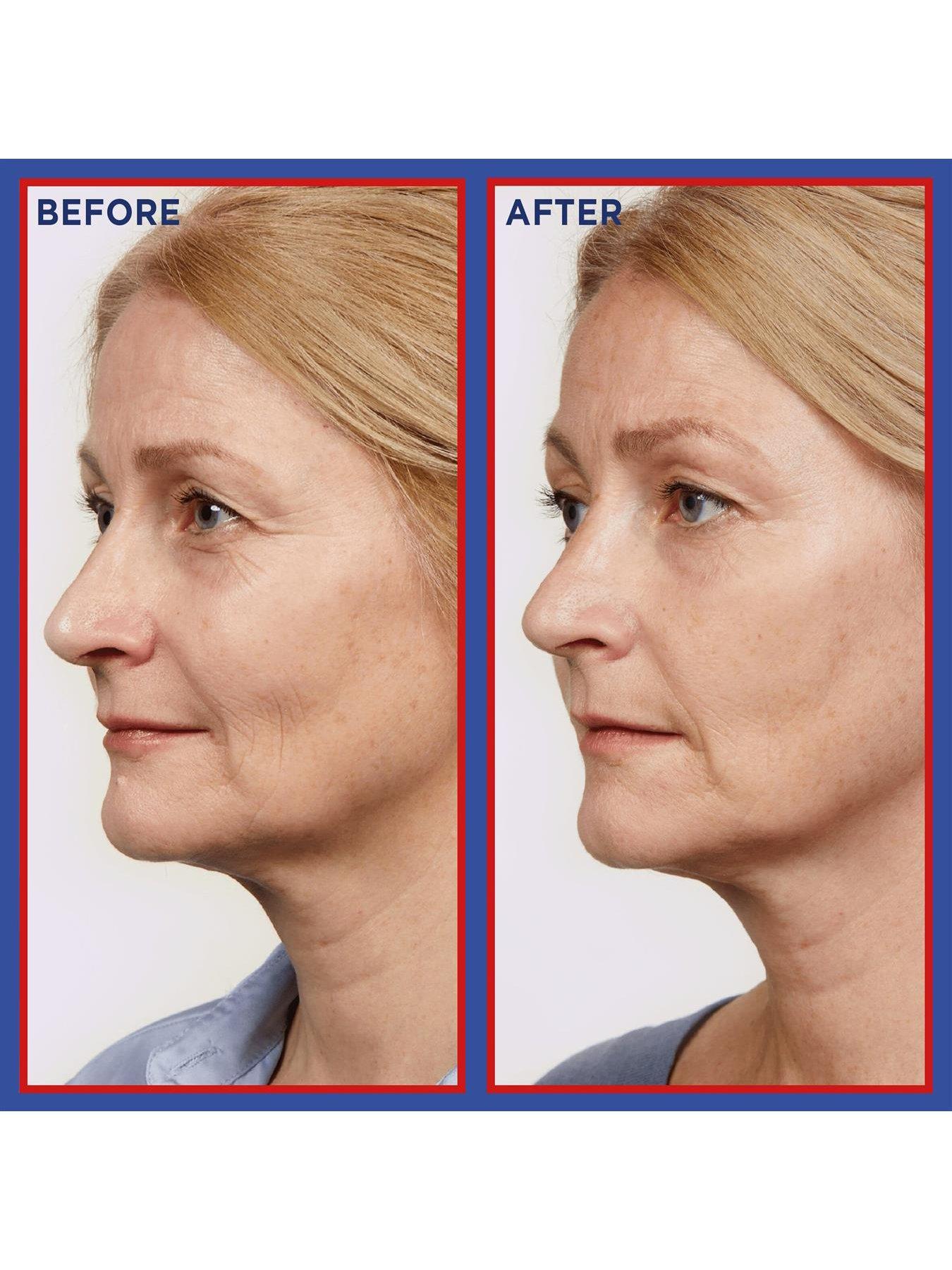 Image 4 of 4 of L'Oreal Paris Revitalift Laser Pure Retinol Deep Anti-Wrinkle Night Serum 30ml