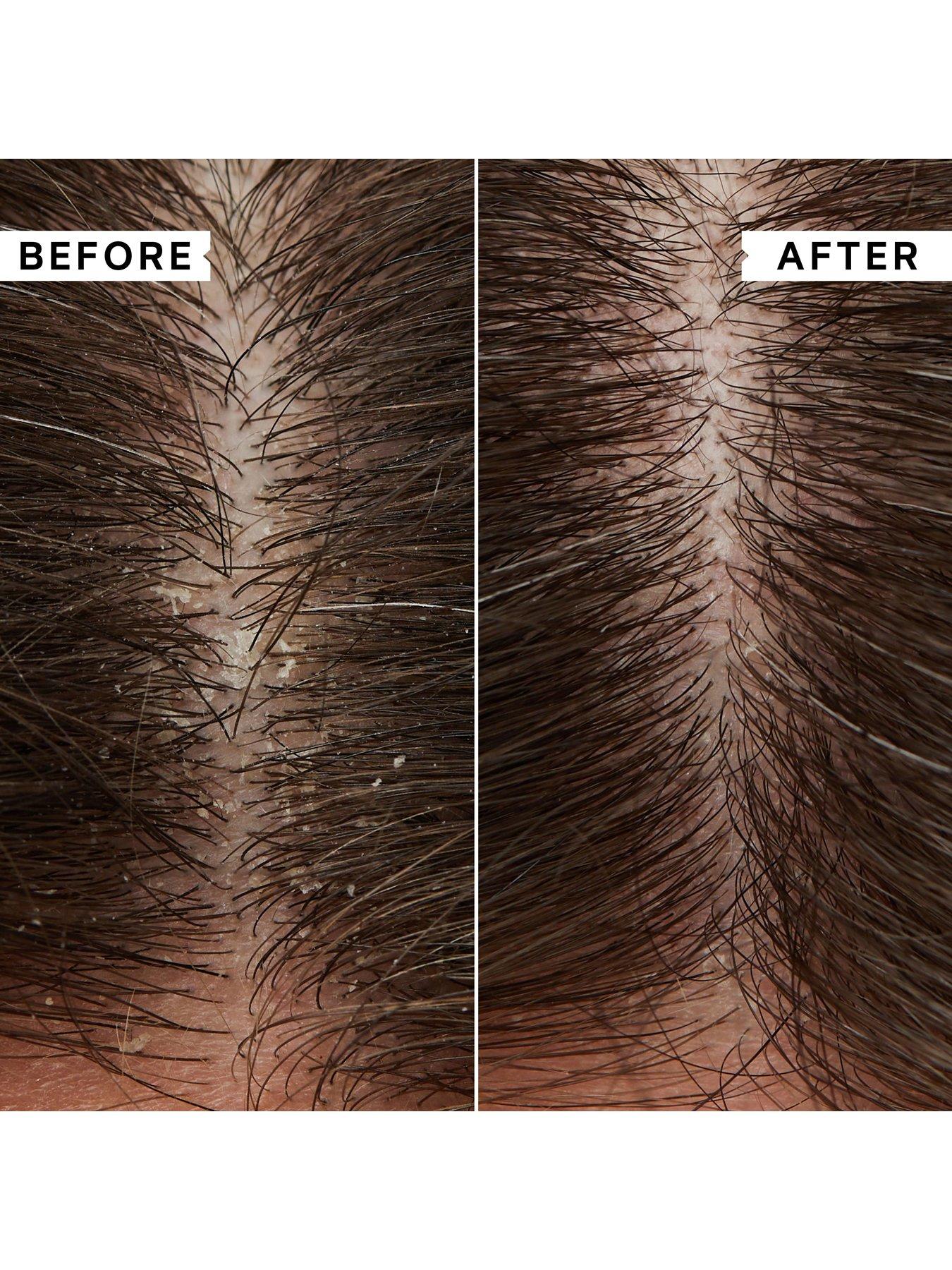 Image 6 of 7 of Philip Kingsley Flaky/Itchy Scalp Hydrating Conditioner 1000ml