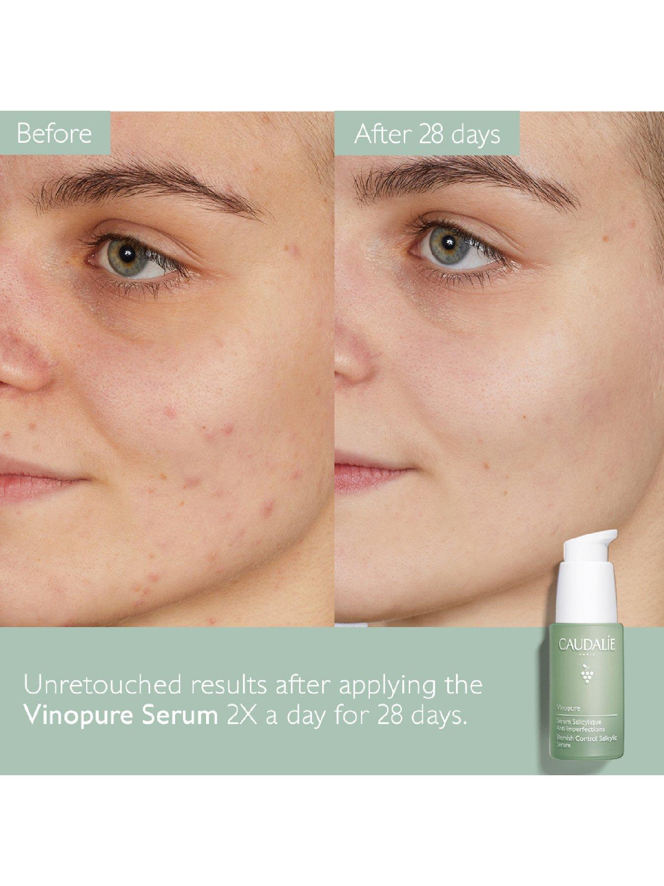 Image 4 of 7 of Caudalie Vinopure Blemish Control Salicylic Serum