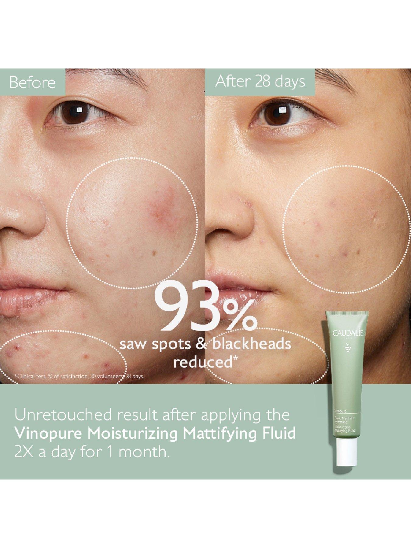 Image 2 of 5 of Caudalie Vinopure Moisturizing Mattifying Fluid