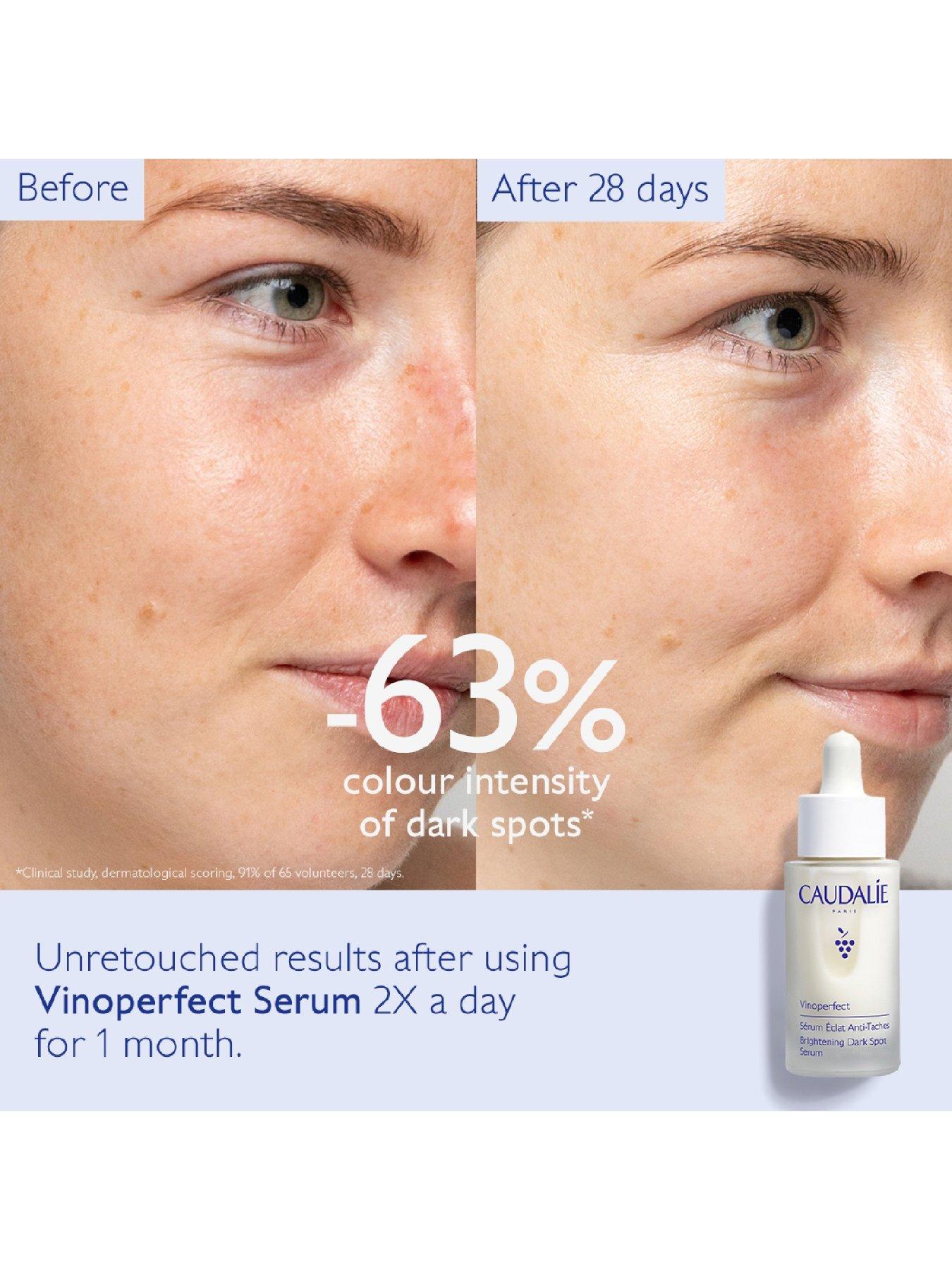 Image 2 of 6 of Caudalie Vinoperfect Brightening Dark Spot Serum 30 ml