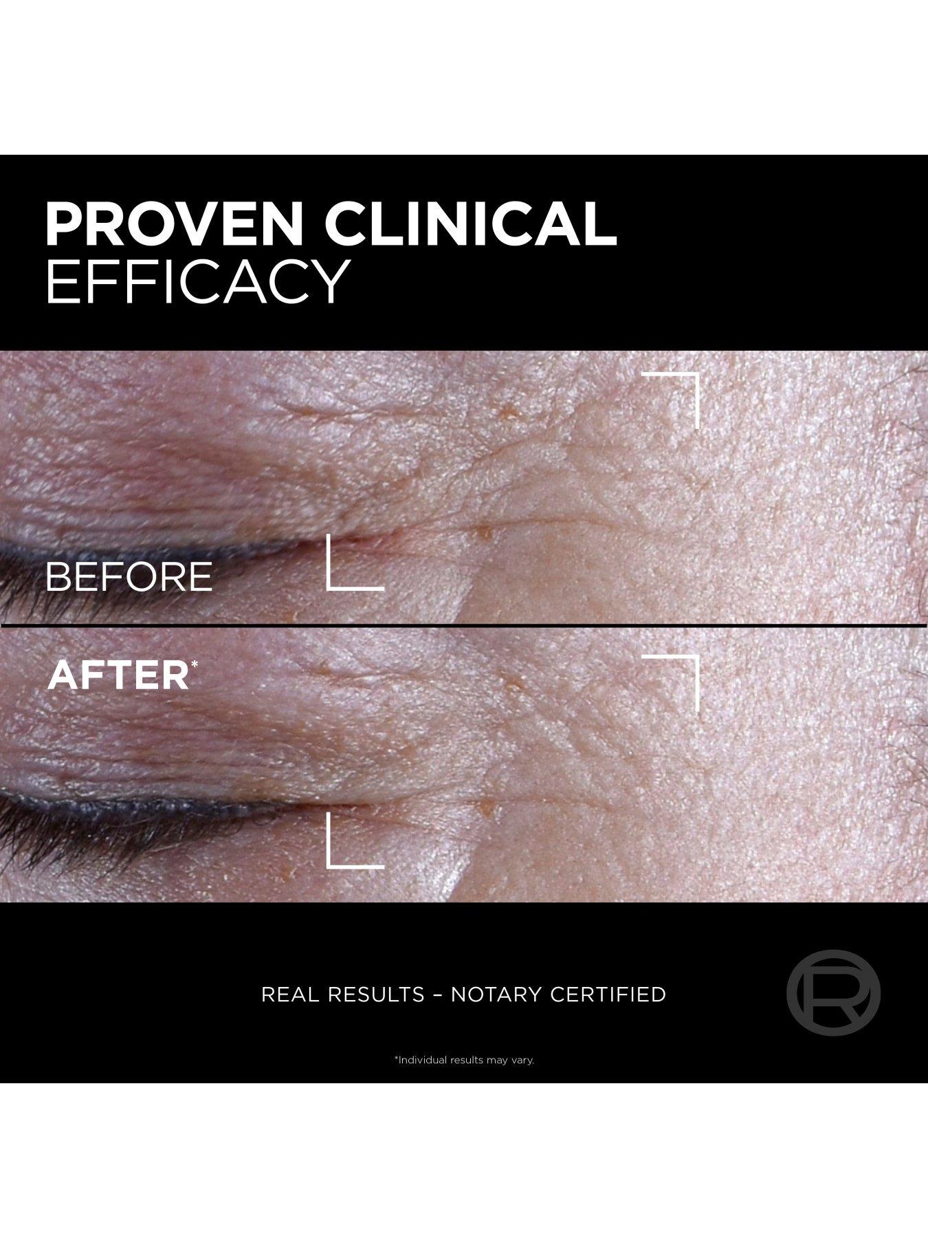 Image 4 of 6 of L'Oreal Paris Age Perfect Cell Renew Midnight Eye Cream -&nbsp;Antioxidant Recovery Complex