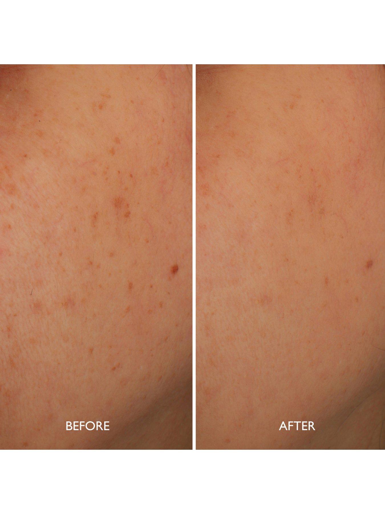 Image 4 of 5 of Gatineau Age Benefit Hyperpigmentation Repair 30ml