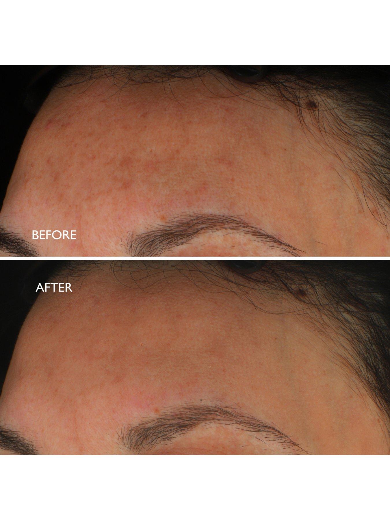 Image 5 of 5 of Gatineau Age Benefit Hyperpigmentation Repair 30ml