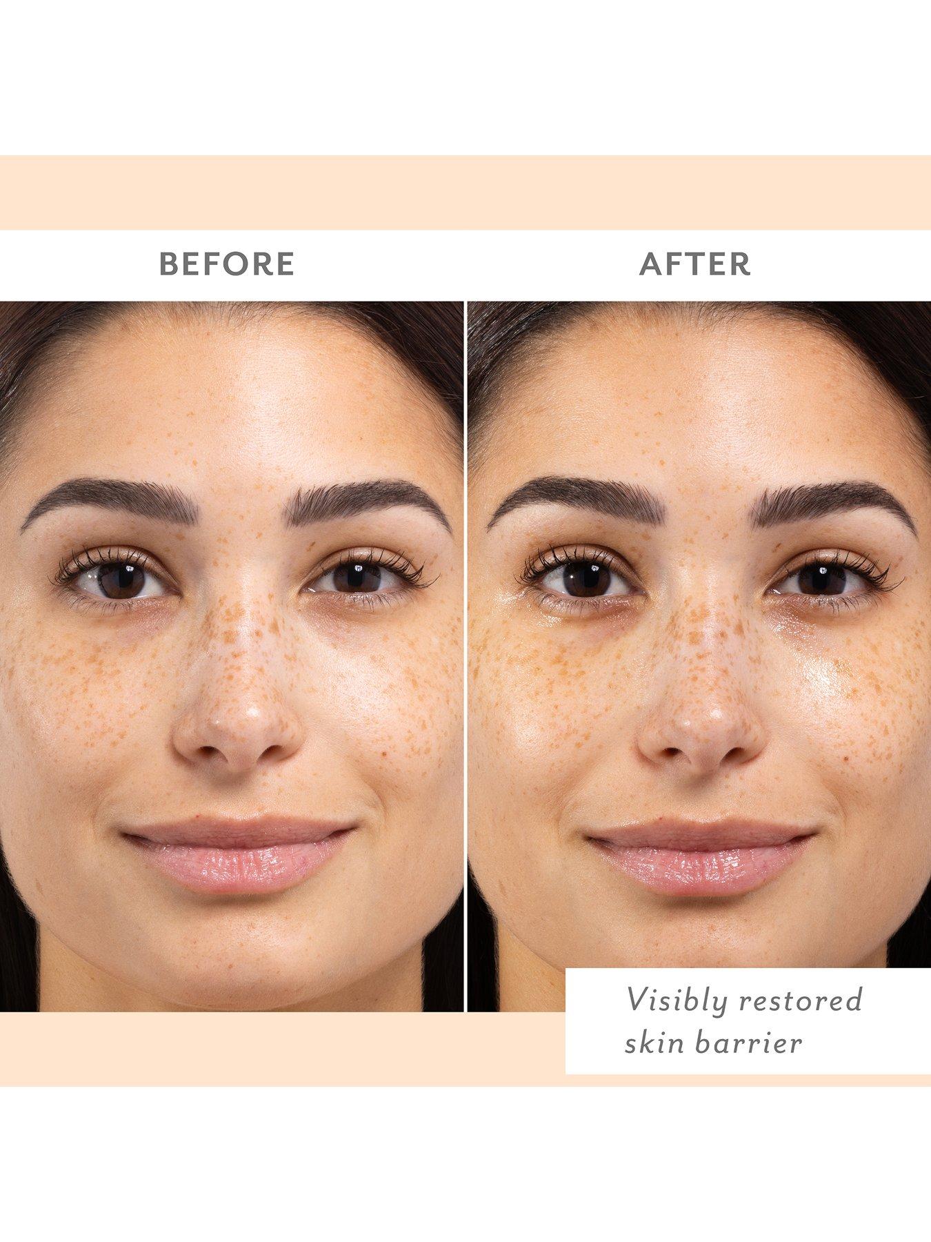 Image 5 of 6 of Patchology Skin Remedy Barrier-Boosting Sheet Mask