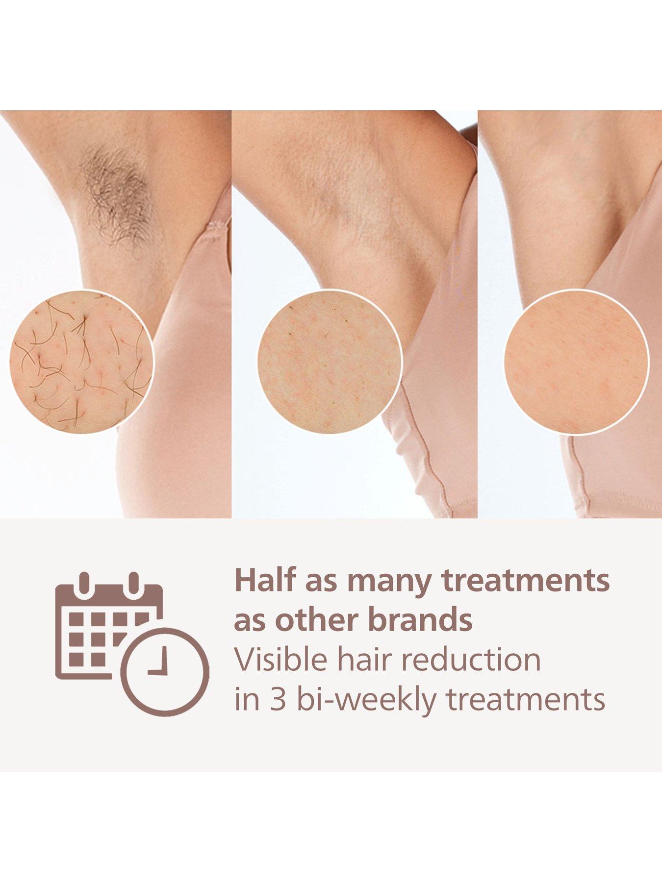 Image 5 of 8 of Philips Lumea Series 9900 BRI953/02, IPL Hair Removal Device, Cordless, Skin AI technology
