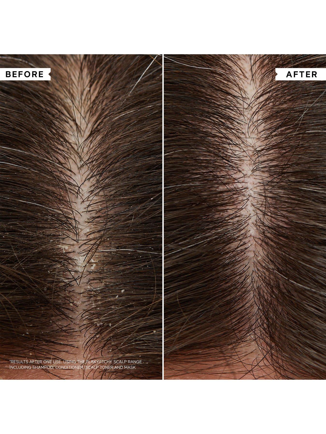 Image 4 of 6 of Philip Kingsley Flaky/Itchy Scalp Hydrating Curl Anti-Dandruff Shampoo 250ml