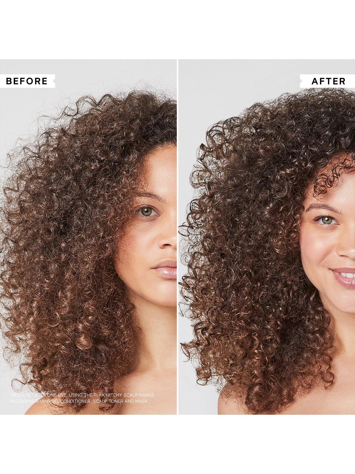 Image 5 of 6 of Philip Kingsley Flaky/Itchy Scalp Hydrating Curl Anti-Dandruff Shampoo 250ml