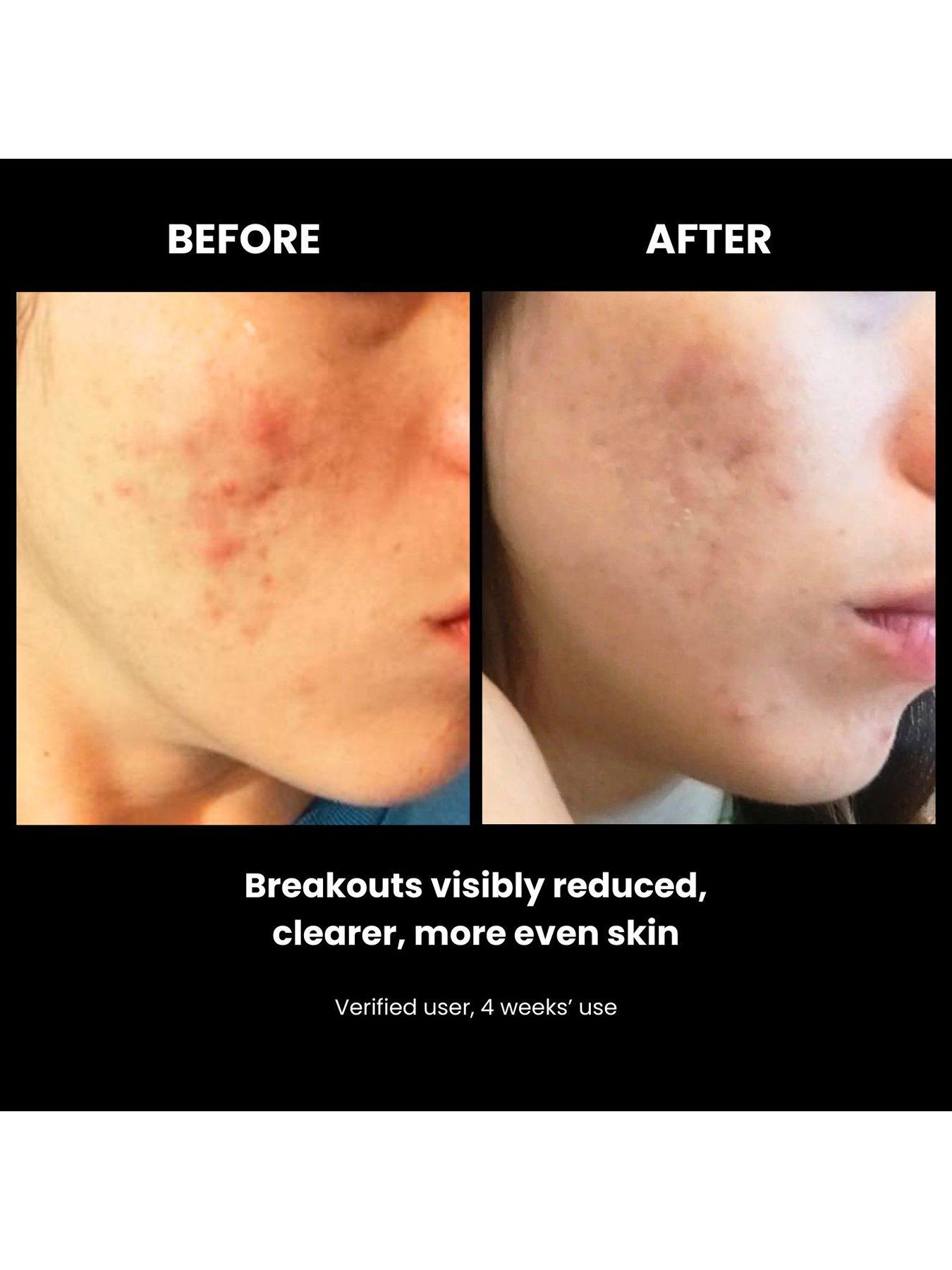 Image 7 of 8 of Lustre Revive LED Face Mask