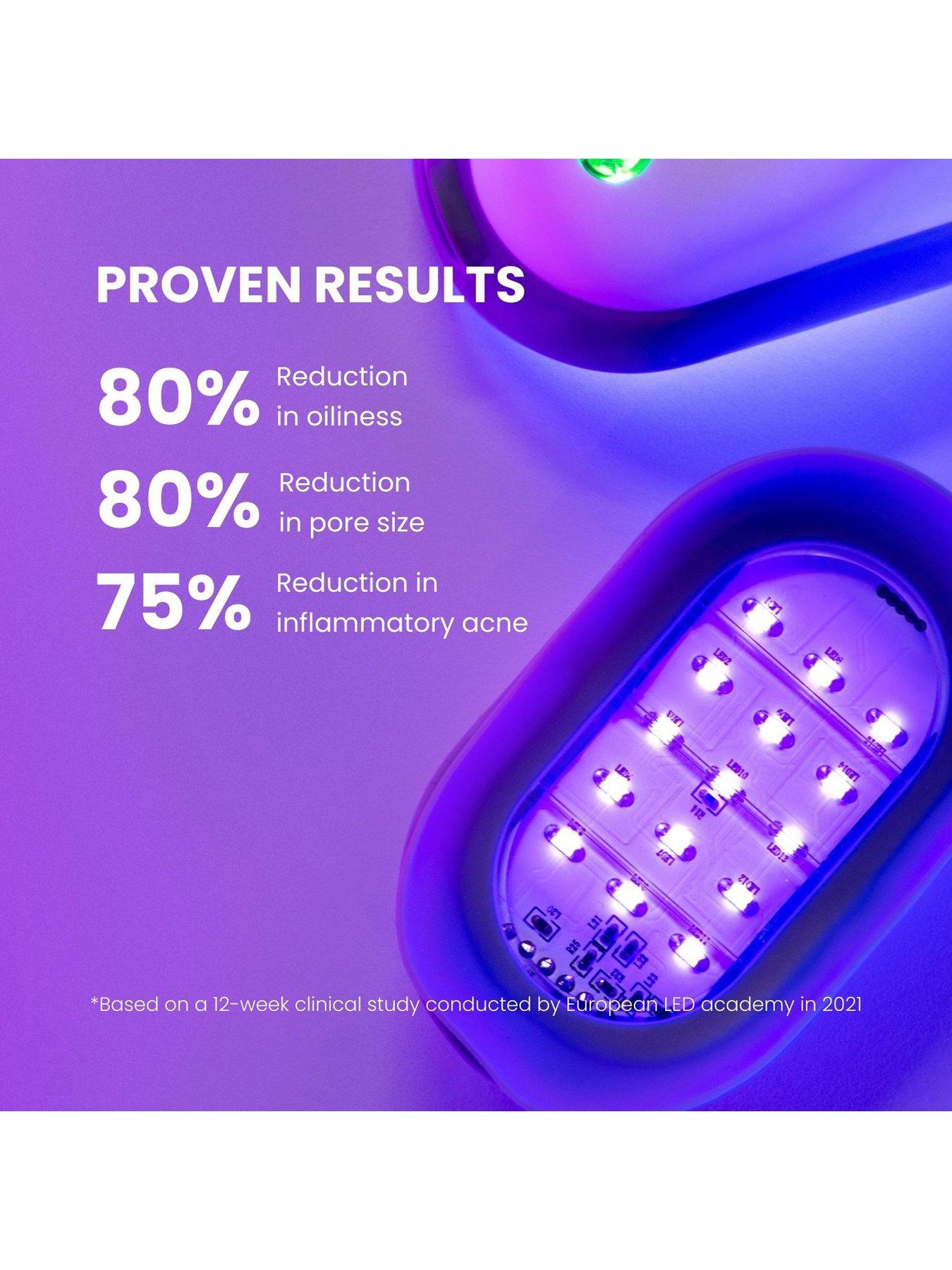 Image 4 of 8 of Lustre Solo LED Acne Pod