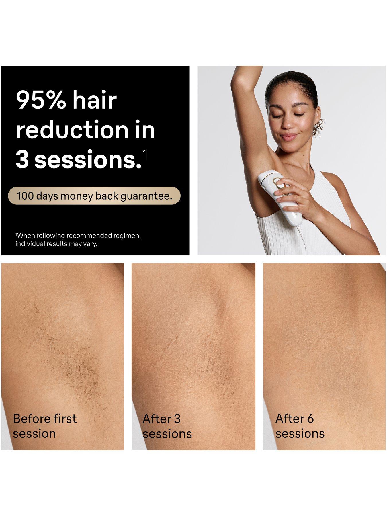 Image 4 of 7 of Braun IPL Silk-expert Pro 5, At Home Hair Removal, 3 Attachment Heads, PL5351