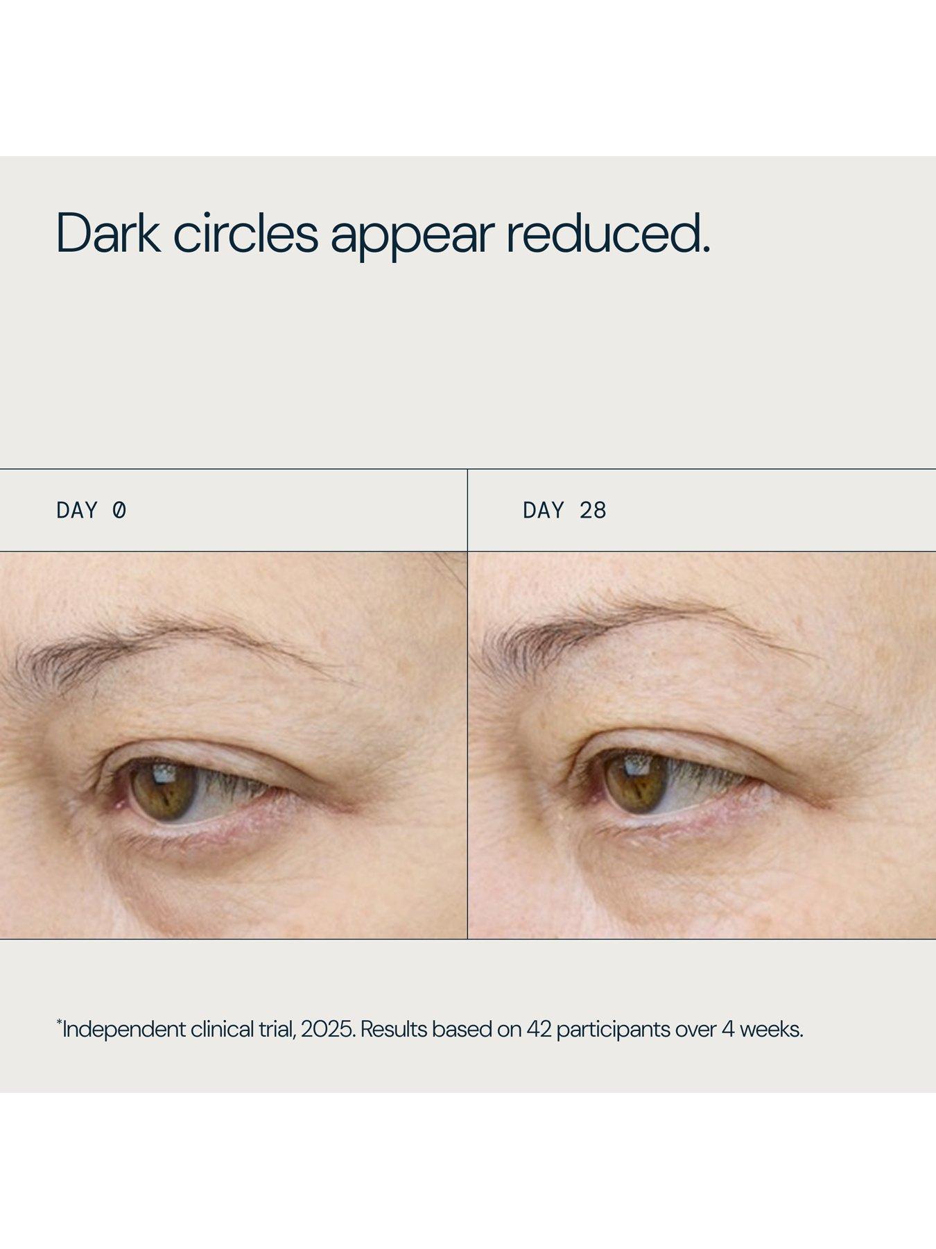 Image 5 of 7 of Elemis Future Restore Eye Serum 15ml